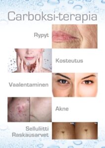 Carboksi terapia ihohoidot kauneushoitolasta Carboksi terapia ihohoidot