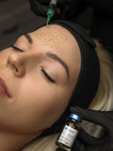 BiorepeelCl3 BiorepeelCl3 L-Beauty kauneushoitola